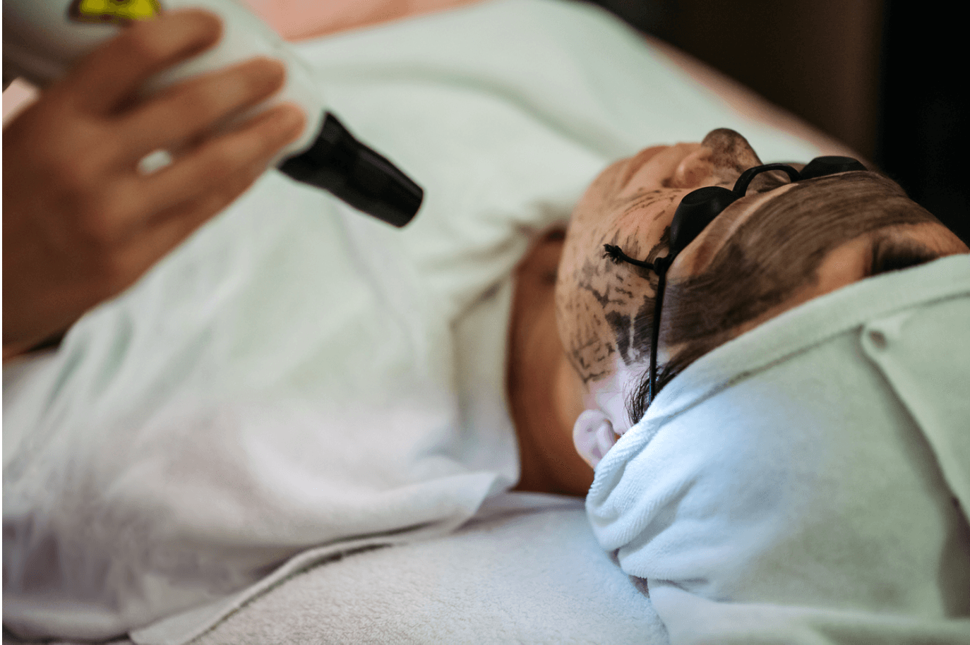 Hollywood Carbon Peel